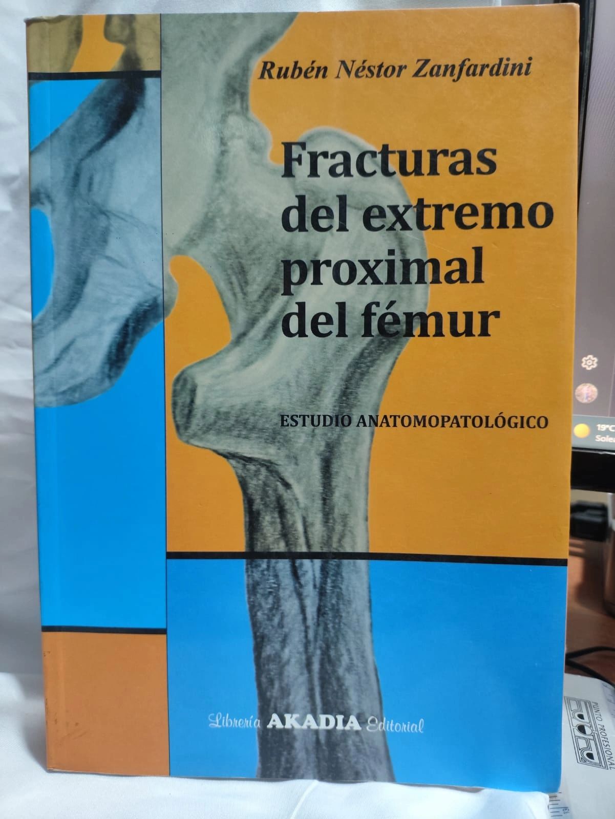 Fracturas del extremo proximal del femur AKADIA