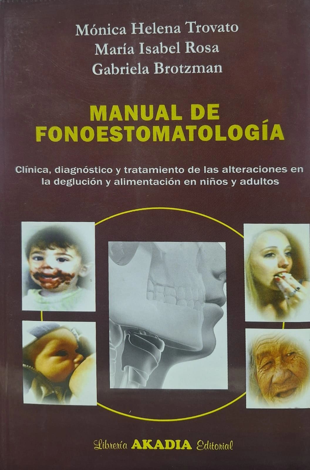 Manual De Fonoestomatologia Clínica, diagnóstico y tratamiento de las alteraciones en deglución y alimentación de niños y adultos Akadia