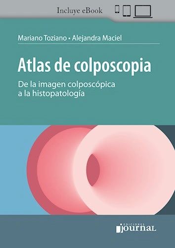 Atlas de Colposcopia Incluye eBook - Ediciones Journal